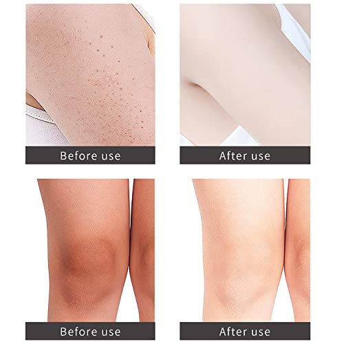 Activated Charcoal Scrub, Naturals Charcoal Exfoliating Body Scrub Polish With Collagen & Stem Cell Gentle Body Exfoliator, Best Shower Scrub Skin Exfoliant For Men & Women 150G #TOP5