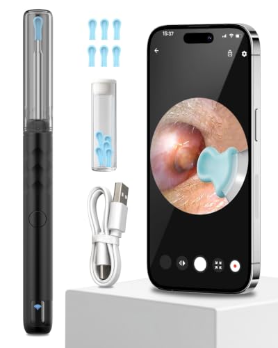 Image of ELECTOMANIA Wireless Ear Wax Removal Tool Kit with 1296P HD Camera 6 LED Lights & Wifi Connection, Ear Cleaning Machine with 5 Silicone Tips Free, Light Weight, IP67 Waterproof for iOS and Android