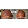 DermiMatch Redness Remover