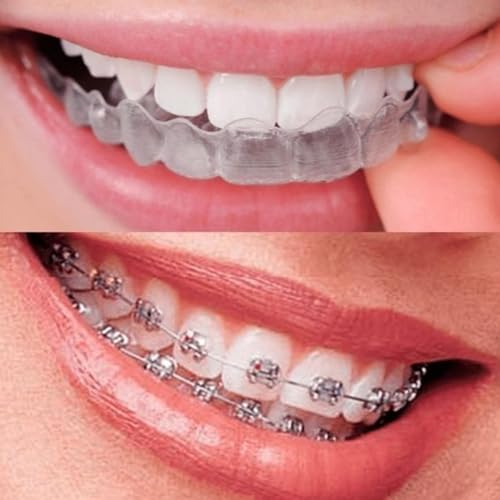 Braces vs Aligners: The Pain Truth You Didn&rsquo;t Expect 😬🔥🦷