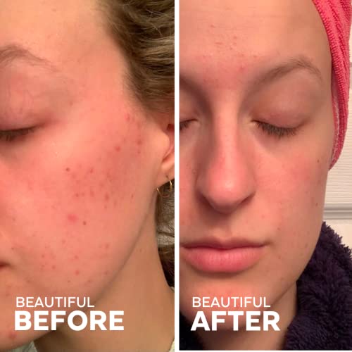 Three Ships Hydrate Almond Oil Serum – As Seen On Dragon's Den - Vegan Facial Serum Moisturizes + Nourishes – Intensive Natural Face Serum For Dry/Normal Skin, 30Ml #TOP4