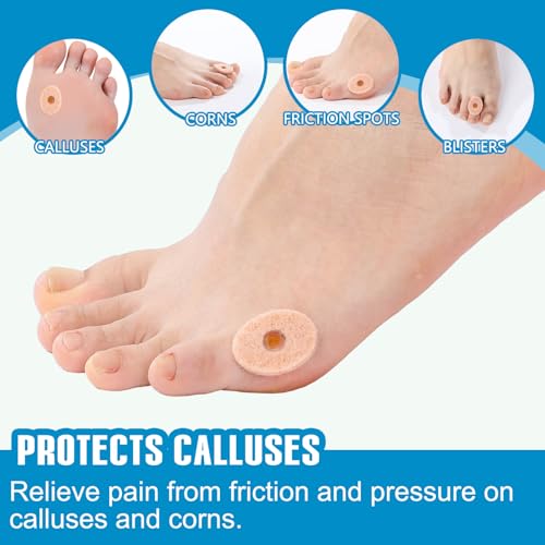 Image of Breling 120pcs Corn Cushions Callus Pads Soft Felt Oval Corn Removers Cushions Protectors for Feet Self stick Adhesive Foot for Toes Relief Pain from Blisters Heel Frictions (Oval,Skin Tone)
