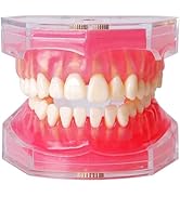 Standard Study Teaching Dental Model with All Removable Teeth - Soft Silicone Gel Gum and Bendabl...