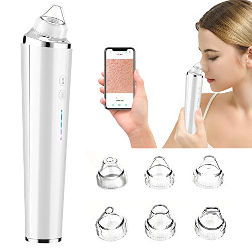 U-Kiss Limpiador de Poros,Extractor Puntos Negros Instrumento, purificador de poros visibles 1296P HD,para eliminar el acné de puntos negros en la cara. 3 modos, microscopio 20X, recargable y 6 sondas