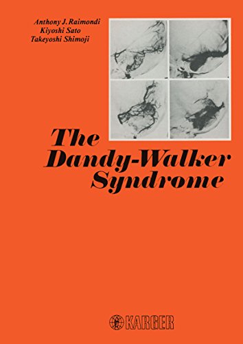 The Dandy-Walker Syndrome (English Edition)