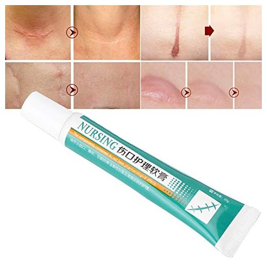 Sår och läkande salva ärrbehandlingsserum, stöder naturlig sårläkning och hudregenerering, minskar risken för ärr för akneärr, fläckar, fina linjer och rynkor