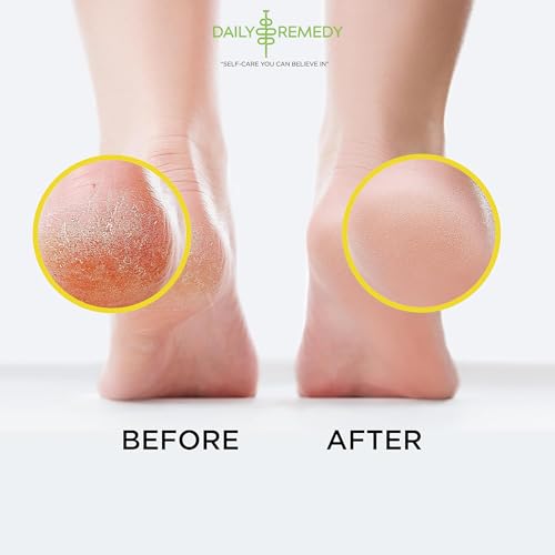 image for DAILY REMEDY Citrus Detox Foot Soak with Epsom Salt - Pack of 2 - Remo