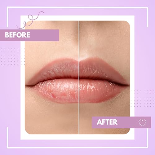 Image of TEE ESS Unisex Vanilla Lip Balm | Hydrating & Plumping Lip Care with Vitamin E, Shea Butter, Jojoba Oil | 4 gms