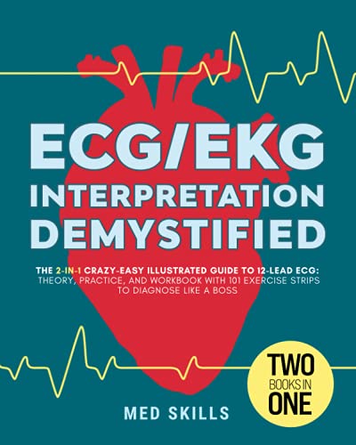 ECG/EKG Interpretation Demystified â€¢ The 2-in-1 Crazy-Easy Illustrated Guide to 12-Lead ECG: Theory, Practice, and Workbook with 101 Exercise Strips to Diagnose like a Boss