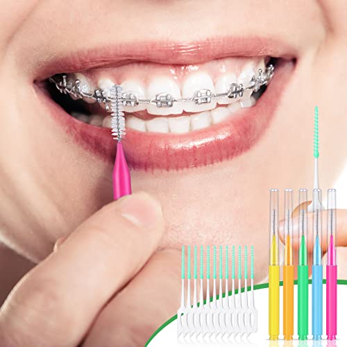 Image of Zopeal 250 Pcs Interdental Brush for Braces Disposable Braces Flossers Dental Picks Floss Toothpick Dental Teeth Flossing Head Oral Hygiene Flosser Toothpick Soft Cleaning Tool (Cute Color)