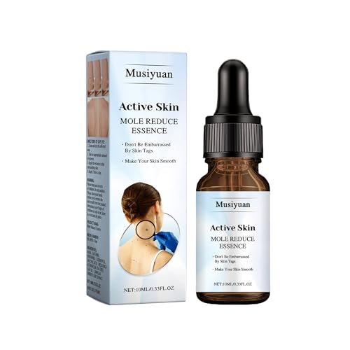 Musiyuan Skin Mole Remover for Hands & Body - Fast Acting Wart Removal with Precision Applicator Skin Tag Remover for Corns Mole Plantar & Common Warts for Body and Hands(0.33 FL.OZ)