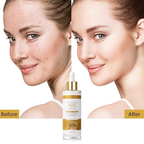 Image of Peel Shot Glow White Rice Exfoliant Peeling Ampoule, Soft Exfoliating Face and Body Scrub, Facial Exfoliator, Deep Hydration Serum, 80ml