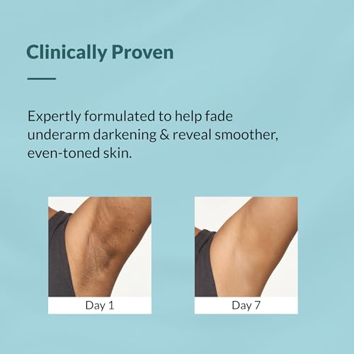 Image of Fixderma Nigrifix Underarm Mist Spray For Dark Underarms Removal 100ml