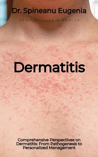 Comprehensive Perspectives on Dermatitis: From Pathogenesis to Personalized Management (English Edition)