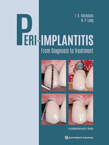 Peri-Implantitis: From Diagnosis to Treatment für 148,00 EUR (-18%) statt 28,00 EUR bei amazon.de Bild: Peri-Implantitis: From Diagnosis to Treatment für 148,00 EUR (-18%) statt 28,00 EUR bei amazon.de