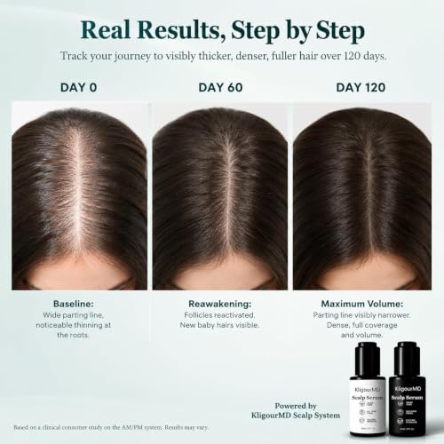 Official KligourMD Hair Serum Bundle Set, Thinning Hair Treatment with Plant-Based Actives, Prevention & Treatment Scalp Serum Bundle for Men & Women, Reduces Hair Fall | Women & Men,G - Image 4
