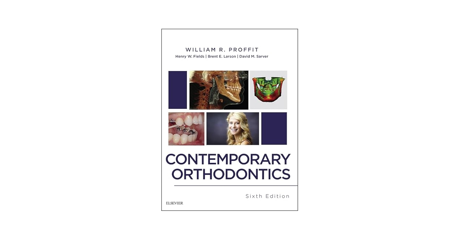 プロフィト　Contemporary Orthodontics 第6版 Contemporary Orthodontics, 6e: South Asia Edition 2019