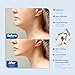 Imagen de ERICAT Dispositivo De Adelgazamiento Facial