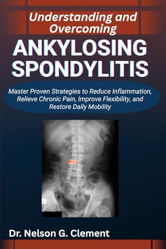 UNDERSTANDING AND OVERCOMING ANKYLOSING SPONDYLITIS: Master Proven Strategies to Reduce