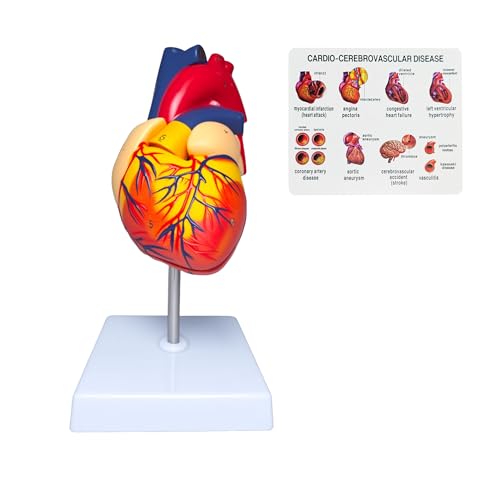 Rkakneecs Life Size Human Heart Model, 2-Part Detachable Anatomical Heart