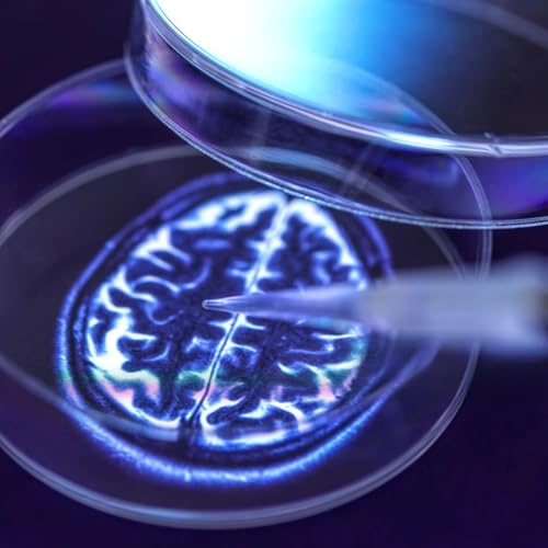 Weekly Dose and Ron Peterson, MD, PhD.. on Alzheimer&rsquo;s and Dementia!