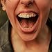 Fun Edgy Gold Plated Hip Hop Teeth Grillz for Men and Women, Fashion Street Hollow Out Double Teeth Grills for Cosplay Parties and Stage Performances(Silver)