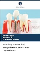 Zahnimplantate bei atrophiertem Ober- und Unterkiefer (German Edition) 6203919357 Book Cover