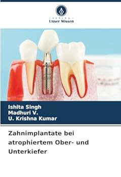 Paperback Zahnimplantate bei atrophiertem Ober- und Unterkiefer [German] Book