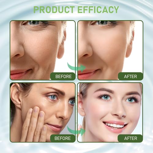 Moossalbe Plus, Moossalbe Gesicht Falten Testsieger, Mooscreme Gegen Falten, Moos Salbe Gesicht, Aktiv Hautreparatur Moossalbe, Mooscreme GEsicht, Instant Effects GEsichts Anti Falten Moos Salbe