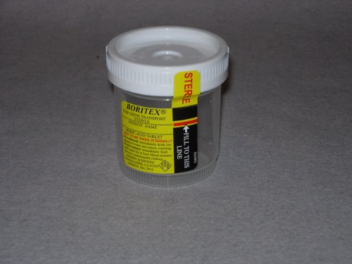 Urinalysis Cup (Borotex) - 200 mg. (400/cs.)