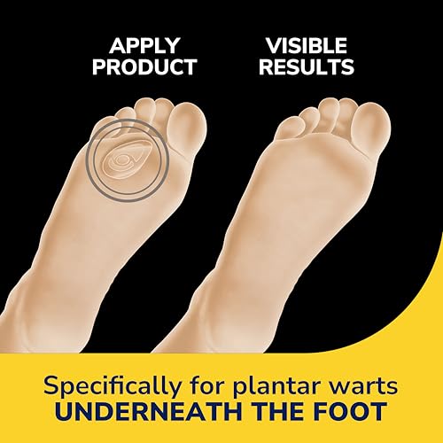 dr scholl39s clear away plantar wart remover hydrogel bandages for feet - clinically proven effective wart removal and cushioning pain relief comfortable multi-day coverage patches