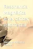  Resonancia Magnética en el cáncer colorrectal