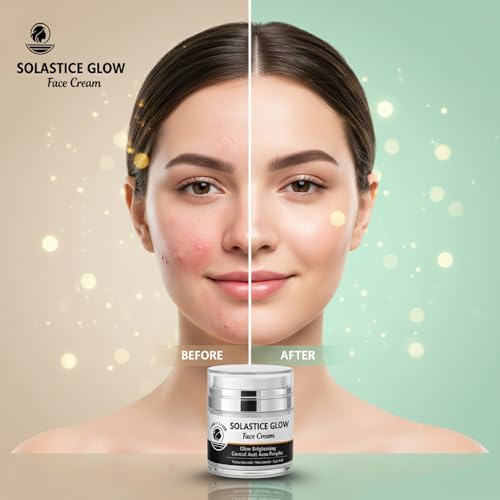 Image of Light Flame Solastice Glow Face Cream for Brightening, Anti-Acne, Pimple Control | Enriched with Hyaluronic Acid, Niacinamide, Kojic Acid | For All Skin Types | Advanced Glow & Clear Skin Care | 50grm