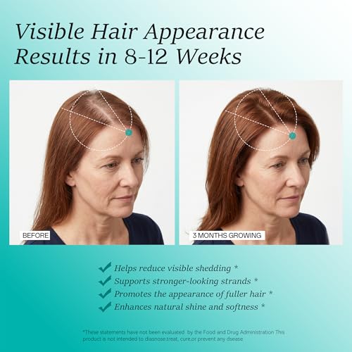 Wiltormin Hair Growth Supplements for Women 30+