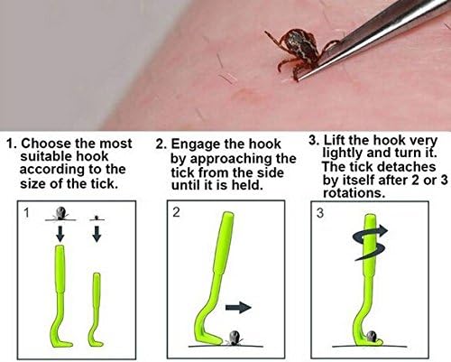 Anti Tick/Lice/Flea/Mite Remover/Picker/Tweezer for Healthy Care of Puppies/Dog/Cat/Kitten (Green) 1