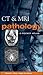CT & MRI Pathology: A Pocket Atlas