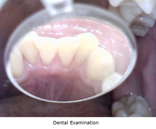Vitiny Um03 Handheld Usb Digital Microscope / Webcam (Up To 320X On 22" Monitor) - Home & Personal Care #TOP3
