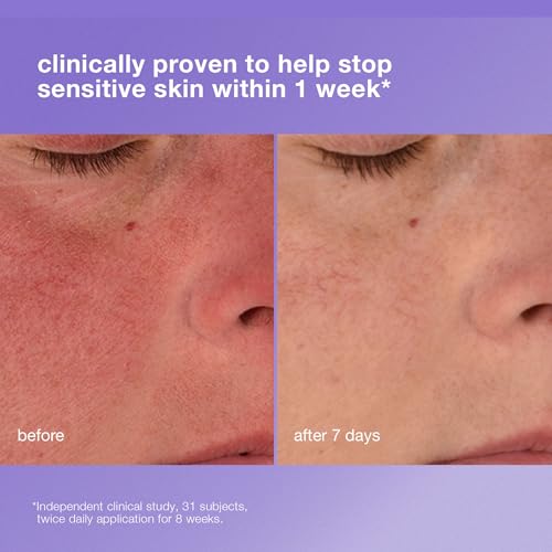 Dermalogica Stabilizing Repair Cream 100ml - Beruhigende Pflege für empfindliche Haut. Lindert Rötungen, Rosacea & stärkt die Hautbarriere.