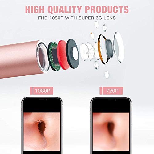Ear Endoscope, 1080P Wireless Ear Wax Removal, Super Light Lens Earwax Cleaning Tool with 6 LED Lights, WiFi Ear Otoscope Camera with 3-Axis Gyroscope, Compatible with Smartphone & Tablet (Rose Gold)