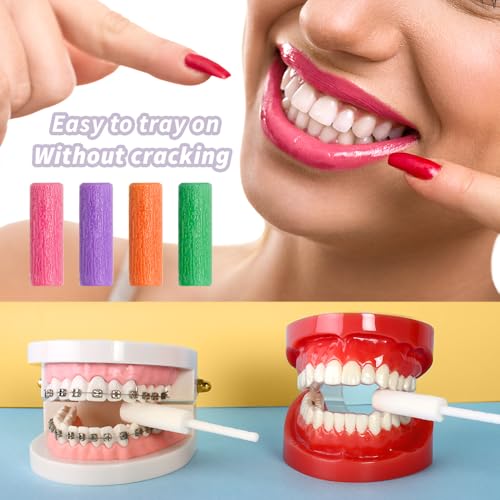 Aligner Tray, 12-Pack Medical Grade Silicone Orthodontic Chompers Aligner Trays Seaters for Invisalign