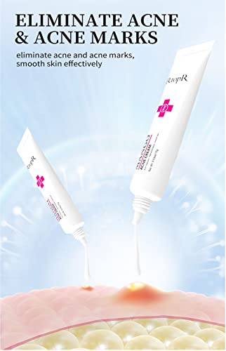 Easilydays Mango Repair Acne Cream, Face Pimple Removal Cream Acne Scar Treatment, Moisturize Skin, Fade Pockmarks Gently And Shrink Pores, For Acne Scar Removal, Spots, Balanced Water And Oil #TOP2