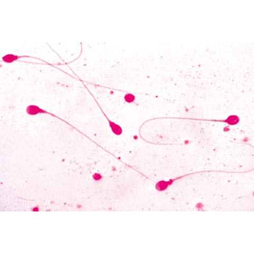 3B Scientific GmbH W13416 Genital System Micro. Slides-Set of 14, Grade: 1 to 2