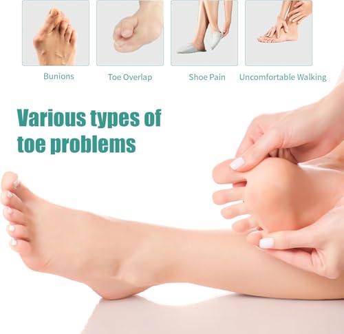 Image of 4 Pcs Silicone Toe Spacers - Yoga Toe Separators for Toe Straightening & Relaxation | Correct Overlapping Toes, Bunions, Hammer Toe | Toe Support toe separators for Women & Men (Tan, 3.98)