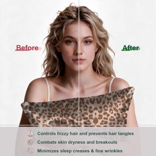 Image of LYSHIN Silk Pillow Cases 2 Pack King Size with Zipper, Leopard | 19 Momme Mulberry Silk Pillowcase for Skin and Hair, Anti-Acne, Hypoallergenic, Cooling, Beauty Sleep, Gifts for Women