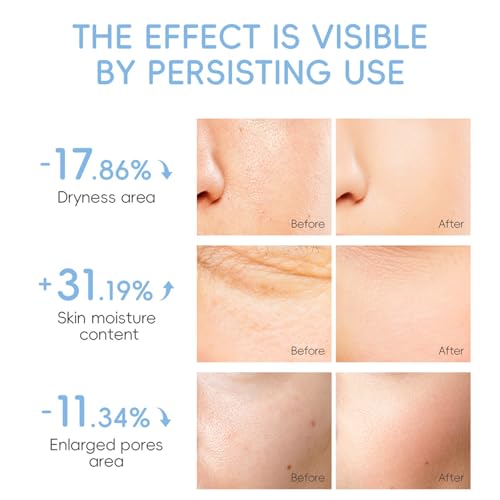 Milk Skin Care Sets & Kits - Teenage Girls Gifts - Milk Skincare Set for Teen Skincare - Gifts For Women - Travel Skincare Set Daily Face Care - Deep Hydrating Smoothing 23PCS - Image 4