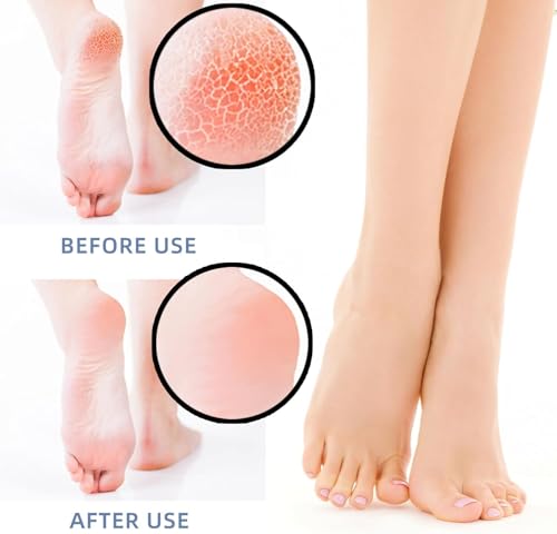 Image of UCRAVO Silicone Heel Protectors for Cracked Heels, Pain Relief & Foot Care -1 Pair Moisturizing Gel Heel Sleeves for Men & Women - Reusable Breathable Silicone Socks for Plantar Fasciitis & Dry Heels