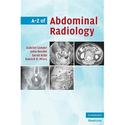 A-Z of Abdominal Radiology (A-Z