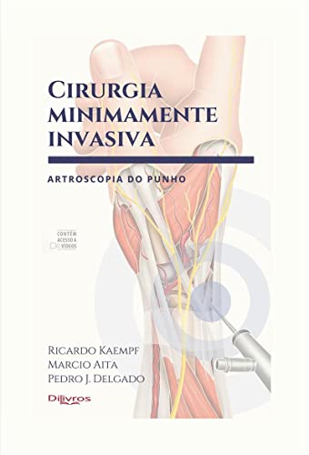 Cirurgia Minimamente Invasiva Artroscopia Do Punho