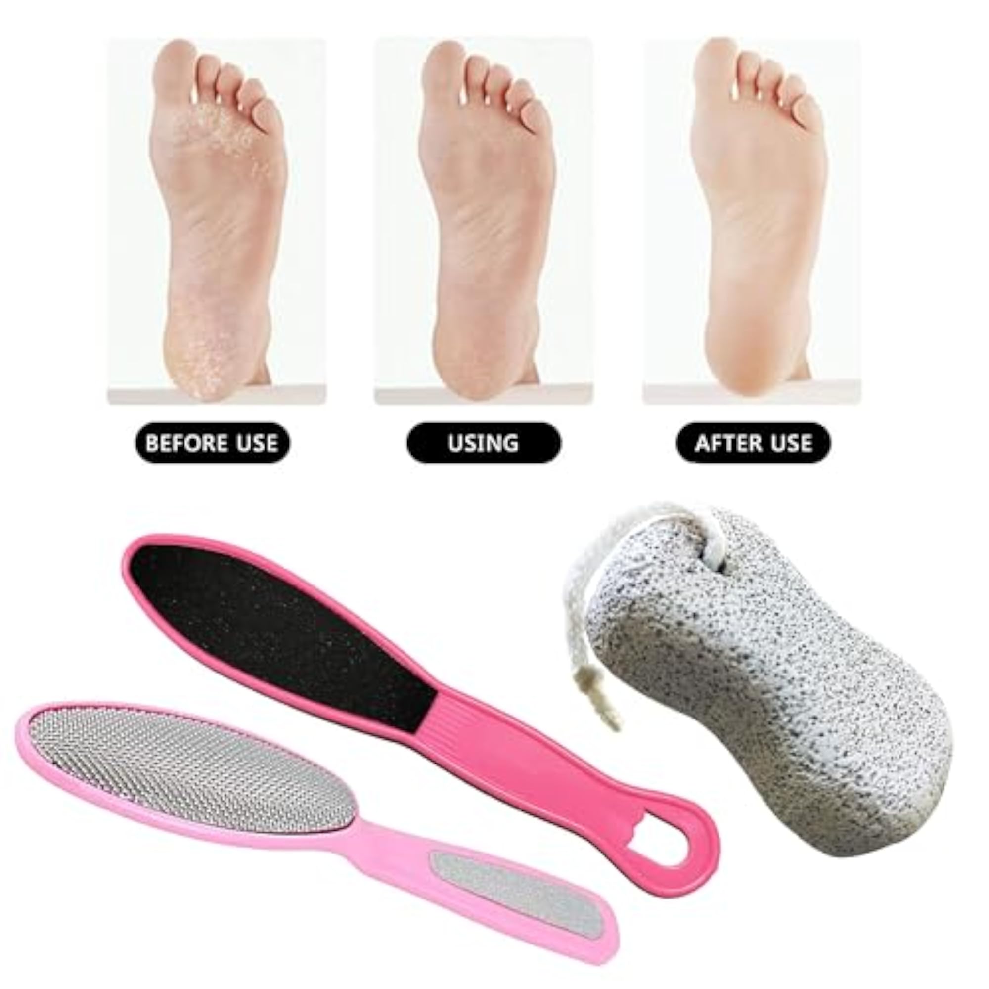 Professional 3 in 1 Pedicure Kit, Foot Scrubber Combo