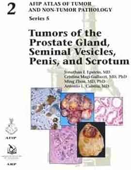 AFIP4th #14 Tumors of the Prostate(新本) Tumors of the Prostate Gland, Seminal Vesicles, and Scrotum (AFIP